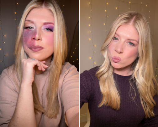 Beauty Wins for Different Skin 🫶🏻 cover photo collage