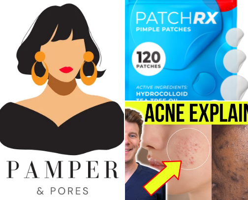 From Breakouts to Breakthroughs: My Triumph Over Severe Cystic Acne cover photo collage