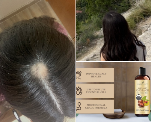 Hair Routine for Bringing Back Healthy Hair  💇🏻‍♀️✨ cover photo collage