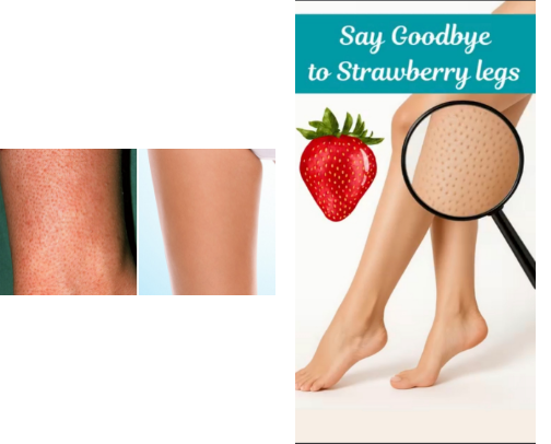 🍓 How I Got Rid of Strawberry Skin           (My Full Routine) cover photo collage