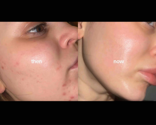 skincare that has saved my skin 🧴🧖‍♀️ cover photo collage