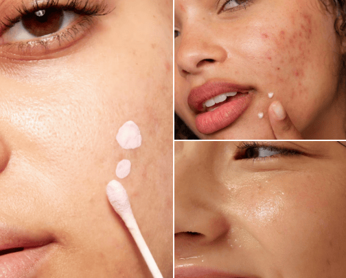 Skin Care cover photo collage