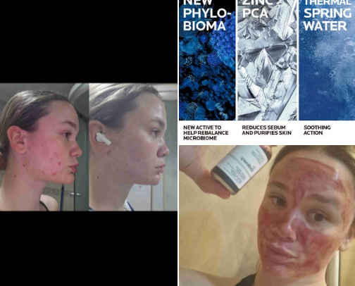 Facial treatment with me, step by step🌻💛 cover photo collage