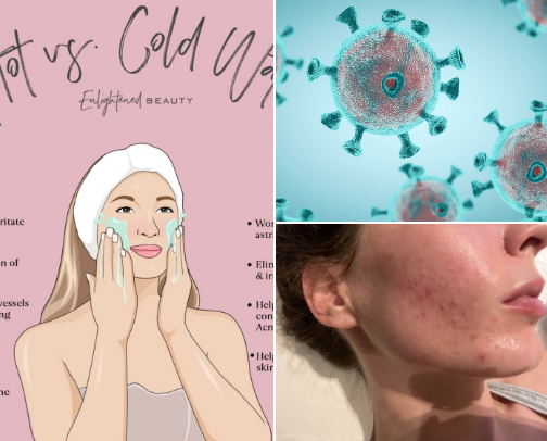 🍁oily skin mistakes I stopped making🍁 cover photo collage