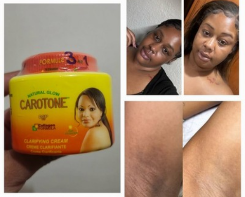 The best bleaching product for skin spots cover photo collage
