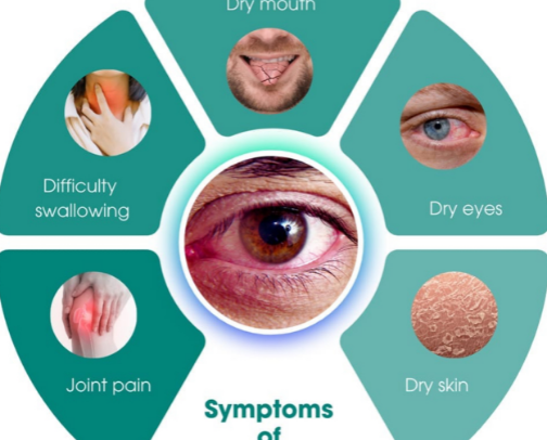 Essentials For My Sjogren’s Family: Things That ACTUALLY Help Me Daily! cover photo collage