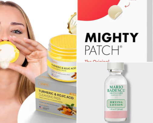 BYE BYE ACNE cover photo collage