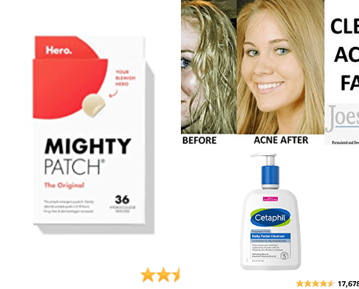 Best buy acne skincare products cover photo collage