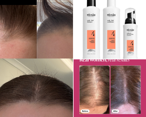 Hair Loss Support & Solutions cover photo collage