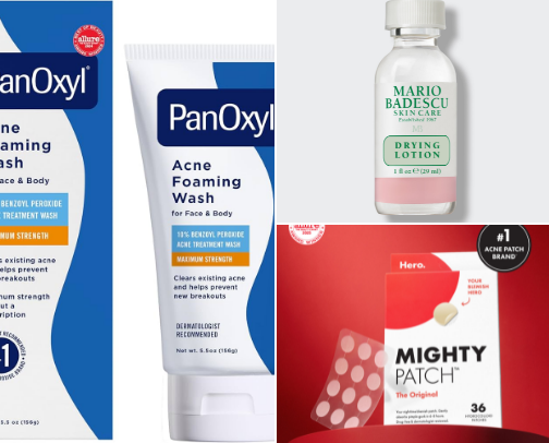 Skincare for acne prone girlys cover photo collage