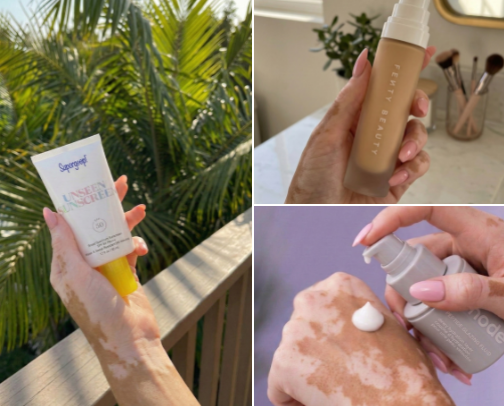 Sensitive Skin & Vitiligo Skincare - My Gentle Beauty Routine cover photo collage