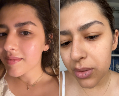 My dry skin savers cover photo collage