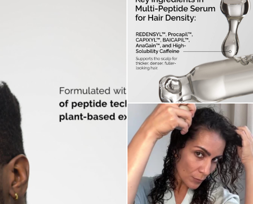 The Scalp Care Routine That Actually Made a Difference in My Hair cover photo collage