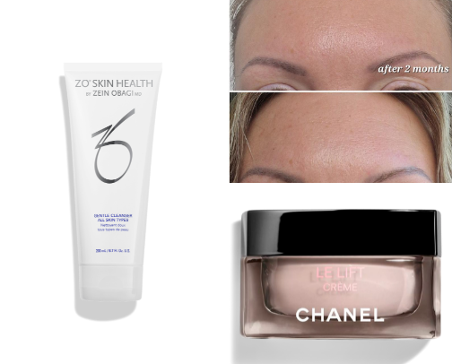 Skin Care!! My recent routine cover photo collage