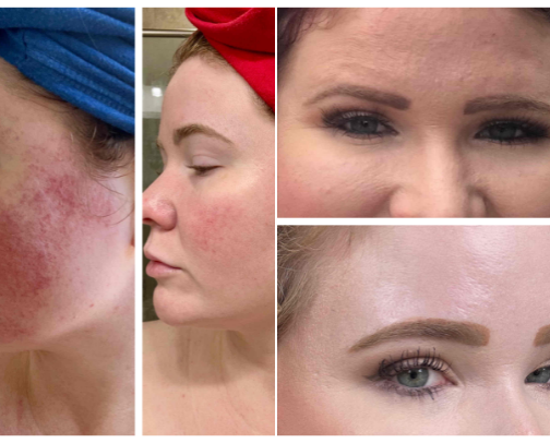 Skincare cover photo collage