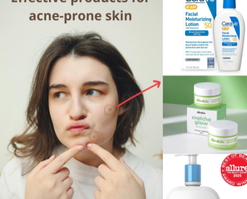 If You Have Severe Acne, You Might Need This. cover photo collage
