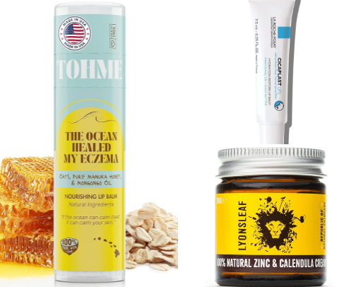 Dermatitis ✨GOD SENDS!✨ cover photo collage