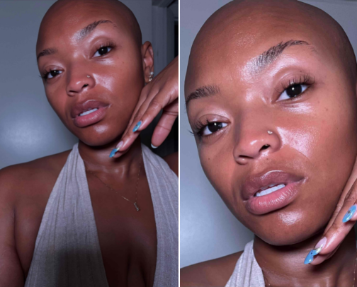 My Dewy Sensitive Skincare Routine ✨ cover photo collage