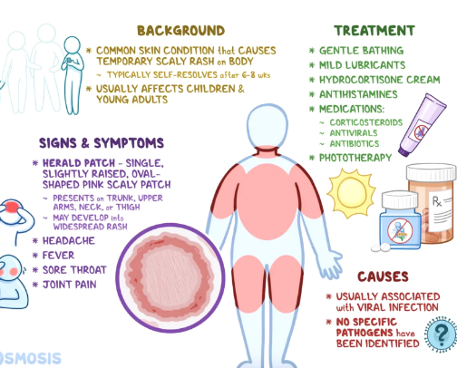 How I Cured my Pityriasis Rosea cover photo collage