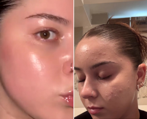 Skincare none negotiables cover photo collage