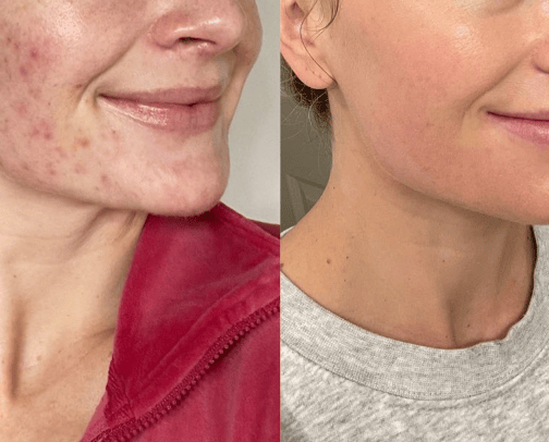 Skincare Products That Completely TRANSFORMED My Skin!!! cover photo collage