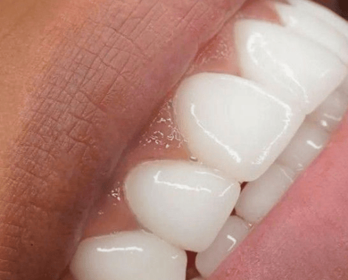Dental care cover photo collage