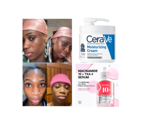 My holy grail skincare product to Dry & Sensitive Skin - Skincare Must Have cover photo collage