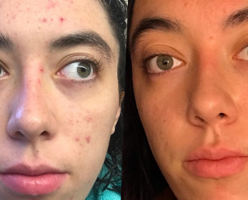 Life Changing Skin Care cover photo collage