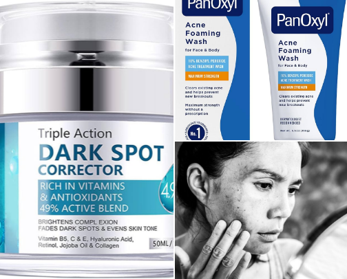 Dark Spot Corrector and Acne treatments cover photo collage