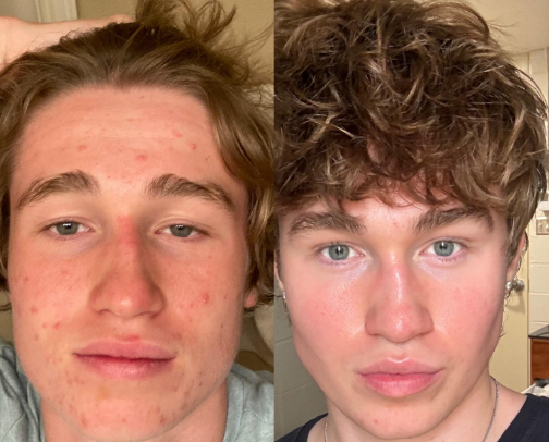 The Skincare Routine That Actually Changed My Skin cover photo collage