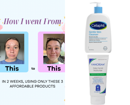Products That Saved My Skin (After Years of Struggle) cover photo collage