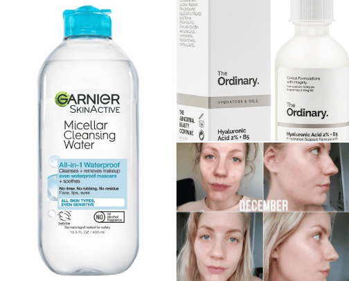 my current skin care routine for clear skin (dry skin edition) !! cover photo collage