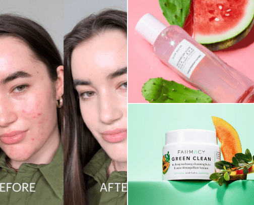 Skincare 10/10✨ cover photo collage