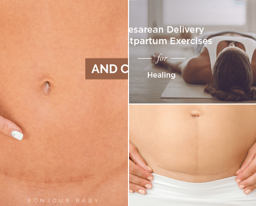 C Section recovery cover photo collage