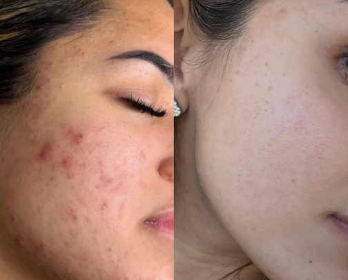 Clear skin must haves 🤍✨ cover photo collage