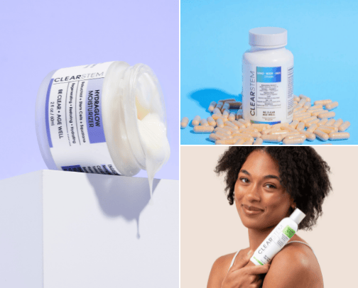 Acne Prone SkinMust Haves - Skincare Edition cover photo collage