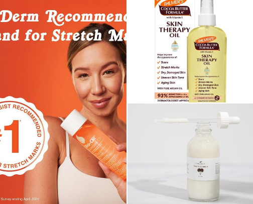 Best oils to prevent stretch marks cover photo collage