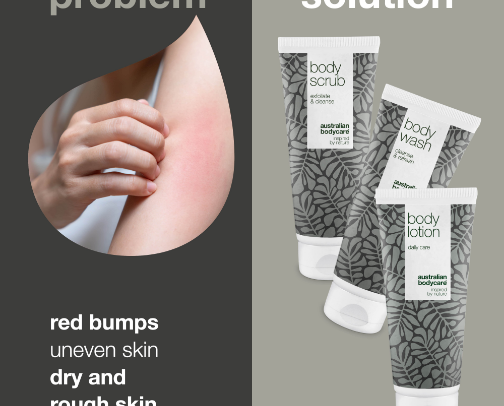 Keratosis Pilaris Recommendations cover photo collage