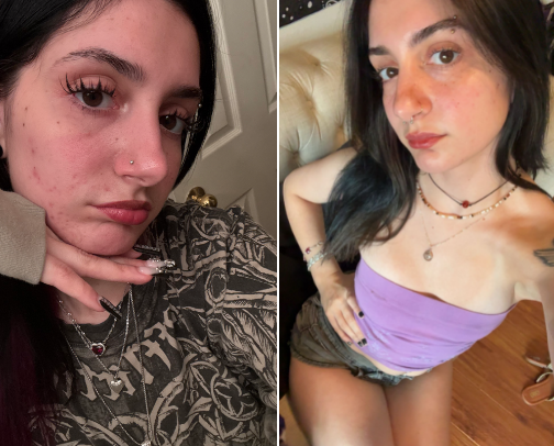 my life changing skin care routine for dry acne prone skin cover photo collage
