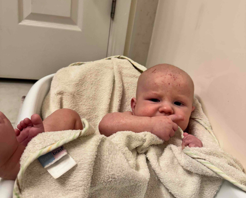 how to clear baby eczema for good cover photo collage