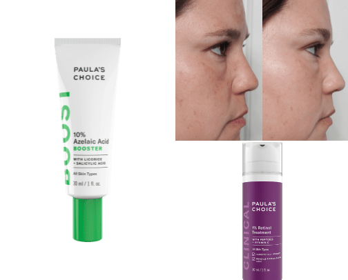 Skincare/problematic skin cover photo collage