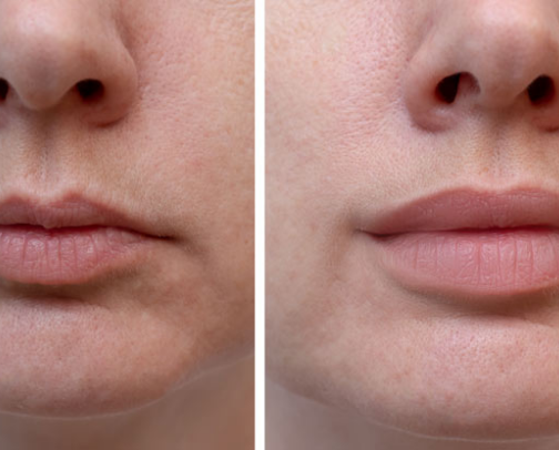 Sephora lipstick cover photo collage