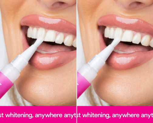 Hi smile - Whitening toothpaste cover photo collage