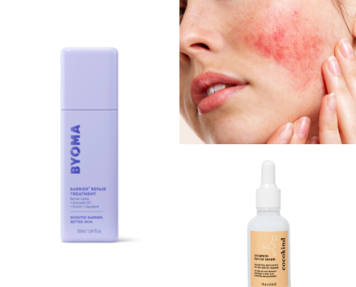 Rosacea Skincare cover photo collage