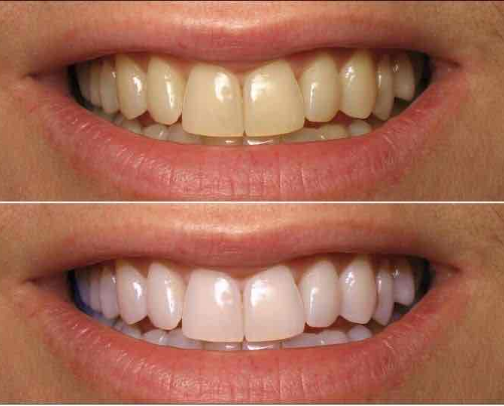 Bright Smile Essentials 😁🦷✨: Oral Hygiene & White Teeth cover photo collage