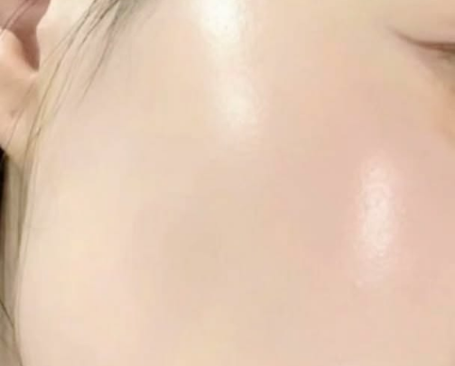 IT Girl Effortless Glowy Skin for Acne-Prone Skin cover photo collage
