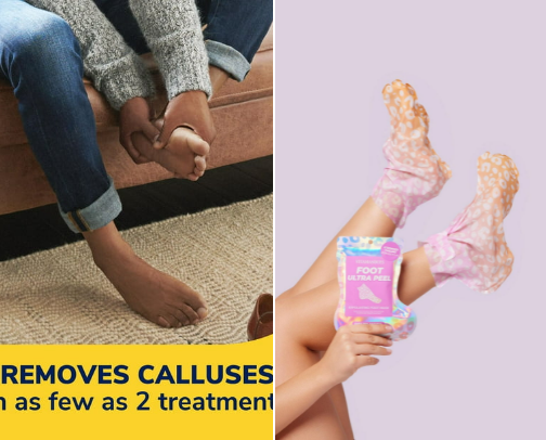 Foot Glow Up 🦶✨ cover photo collage