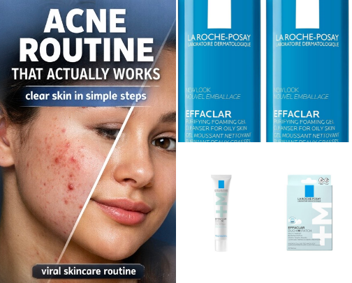 Acne Routine That Actually Works (Affordable & Simple) cover photo collage