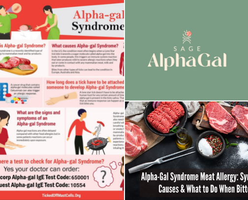 Living with Alpha-Gal Syndrome: Safe Recipes, Allergy-Friendly Foods, and Everyday Resources cover photo collage