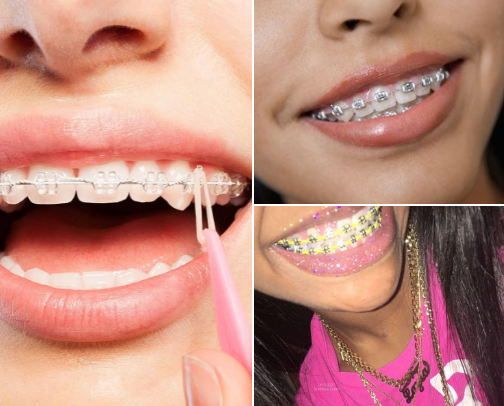 𝐛𝐫𝐚𝐜𝐞𝐬 𝐜𝐨𝐥𝐨𝐫𝐬 cover photo collage